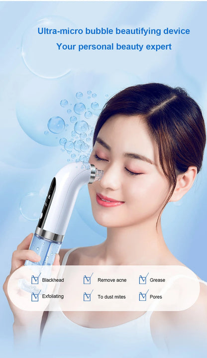 Electric Blackhead Remover Vacuum